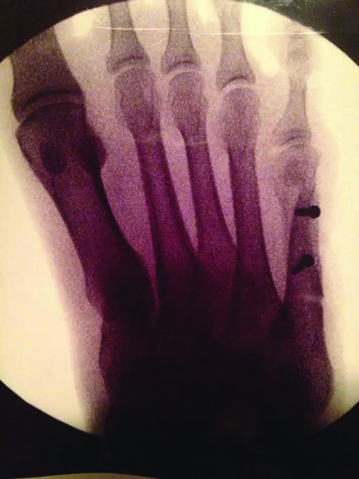 X-ray of Clemons' right foot.